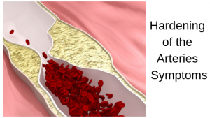 Hardening of the Arteries Symptoms