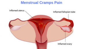 Menstrual Cramps Pain