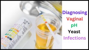 Diagnosing Vaginal pH Yeast Infections