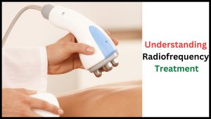 Understanding Radiofrequency Treatment