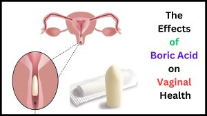 The Effects of Boric Acid on Vaginal Health