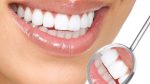 Teeth Whitening: Whiten Teeth Easily, Naturally and Forever!