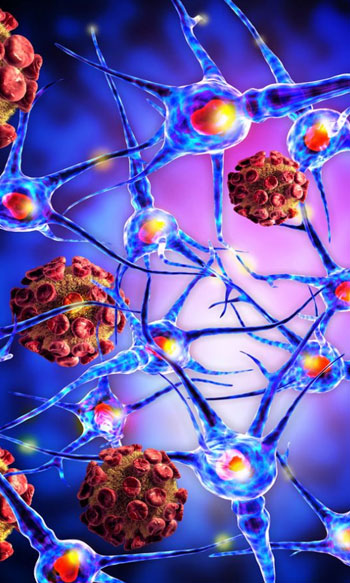 Do Autoimmune Diseases Cause High Blood Pressure 