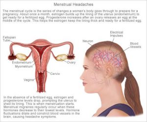 Menstrual Headaches