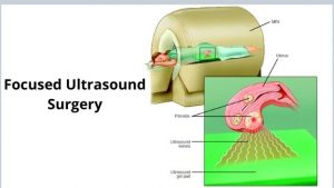 Focused ultrasound surgery