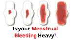 Is your Menstrual Bleeding Heavy – Reasons & How to stop it.