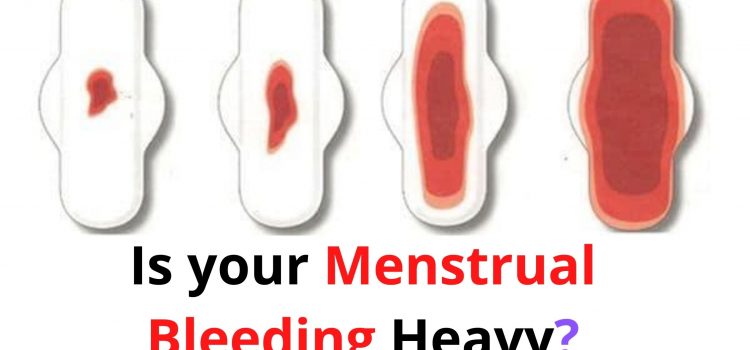 Is your Menstrual Bleeding Heavy