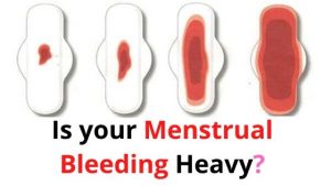 Is your Menstrual Bleeding Heavy_