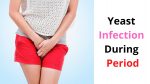 Yeast Infection During Period – Causes, Symptoms & Treatments