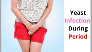 Yeast Infection During Period