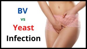 BV vs Yeast Infection