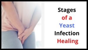 Stages of a Yeast Infection Healing