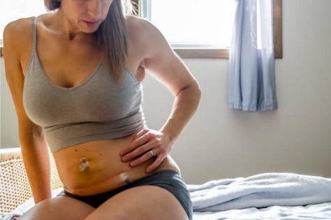 Hysterectomy cost: Detailed Guide on Cost, Types & Post-op Hysterectomy cost