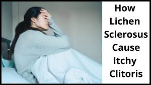 How Lichen Sclerosus Cause Itchy Clitoris