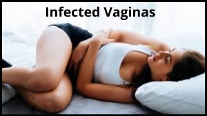 Infected Vaginas