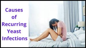 Causes of Recurring Yeast Infections
