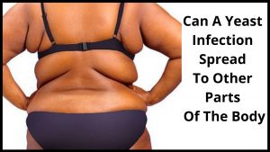Can A Yeast Infection Spread To Other Parts Of The Body