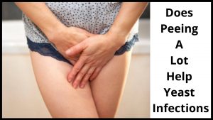 Does Peeing A Lot Help Yeast Infections