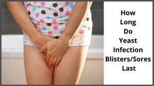 How Long Do Yeast Infection Blisters/Sores Last