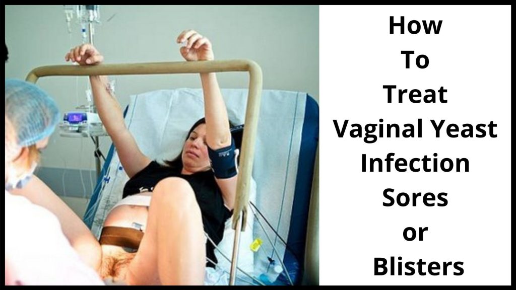 Vaginal Yeast Infection Blisters Causes Appearance And Treatment