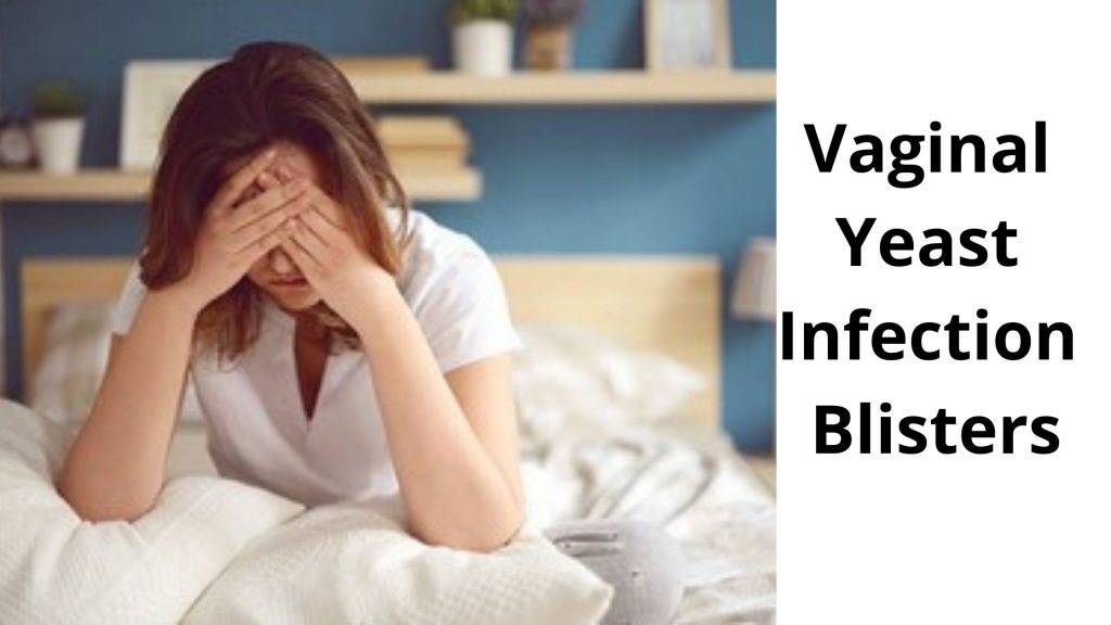 Vaginal Yeast Infection Blisters