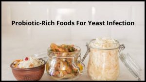 Probiotic-Rich Foods For Yeast Infection
