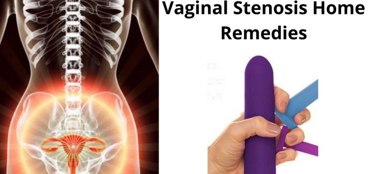 Vaginal Stenosis Home Remedies