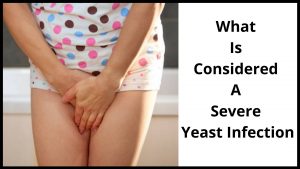 What Is Considered A Severe Yeast Infection?