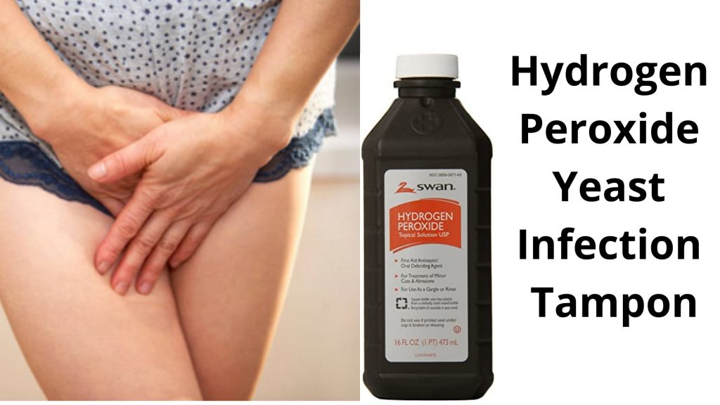 Hydrogen Peroxide Yeast Infection Tampon