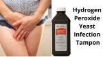 Hydrogen Peroxide Yeast Infection Tampon: Why and How To Use