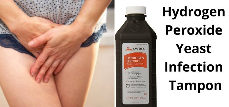 Hydrogen Peroxide Yeast Infection Tampon