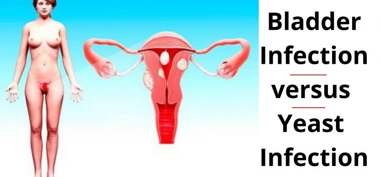 Bladder Infection versus Yeast Infection