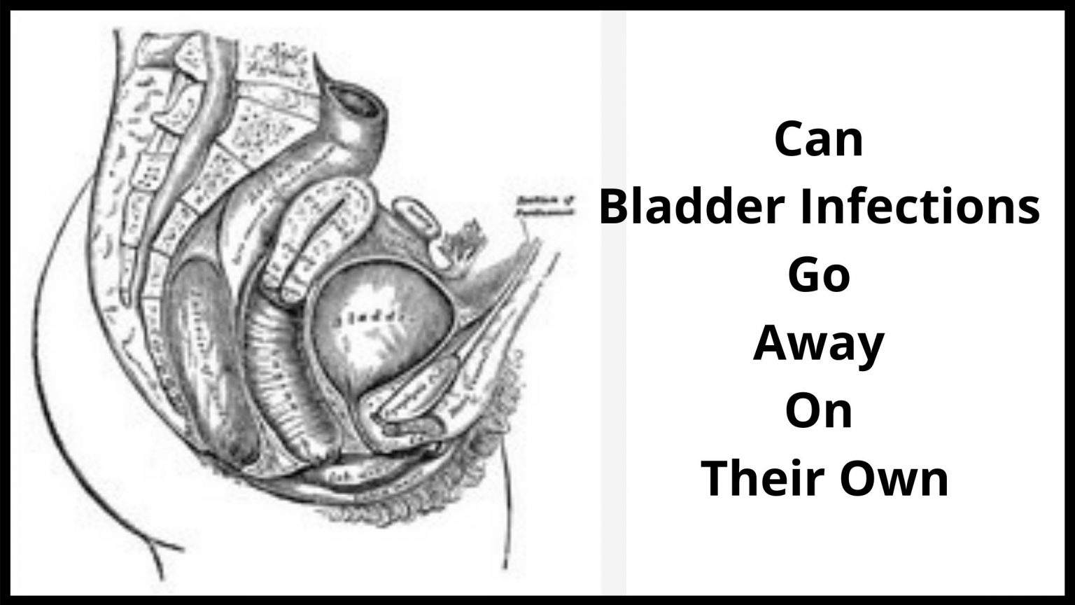 Can Bladder Infection Cause Yeast Infection