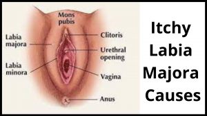 Itchy Labia Majora Causes