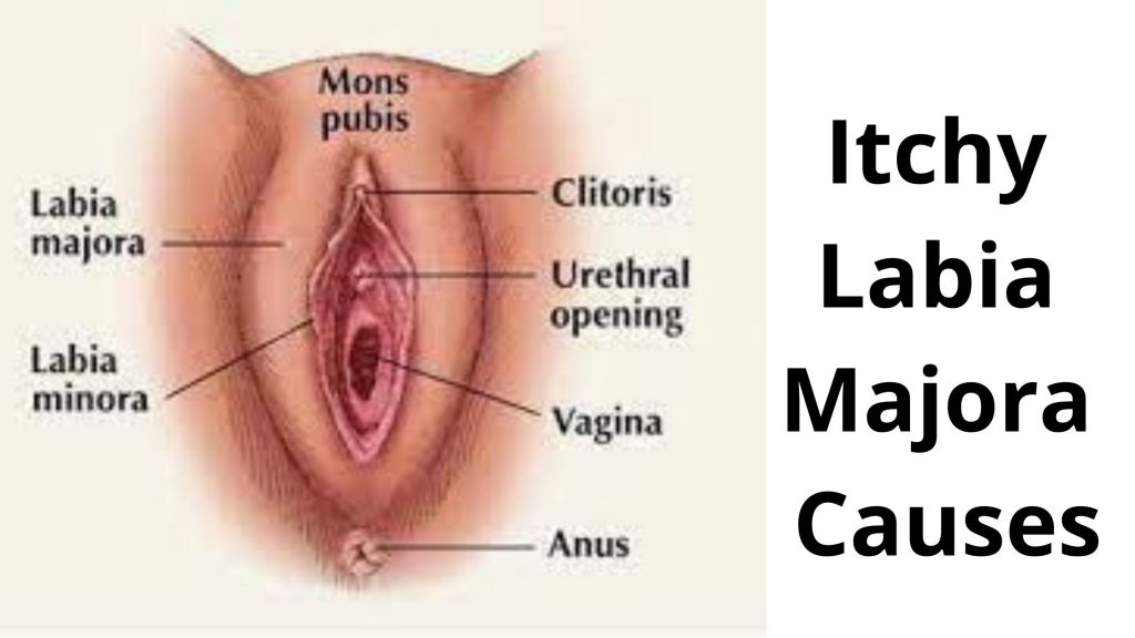 Itchy Labia Majora Causes