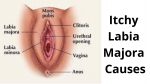 17 Itchy Labia Majora Causes: Facts that you’ve not been told