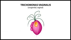  Bacterial vaginosis