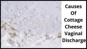 causes of cottage cheese vaginal discharge