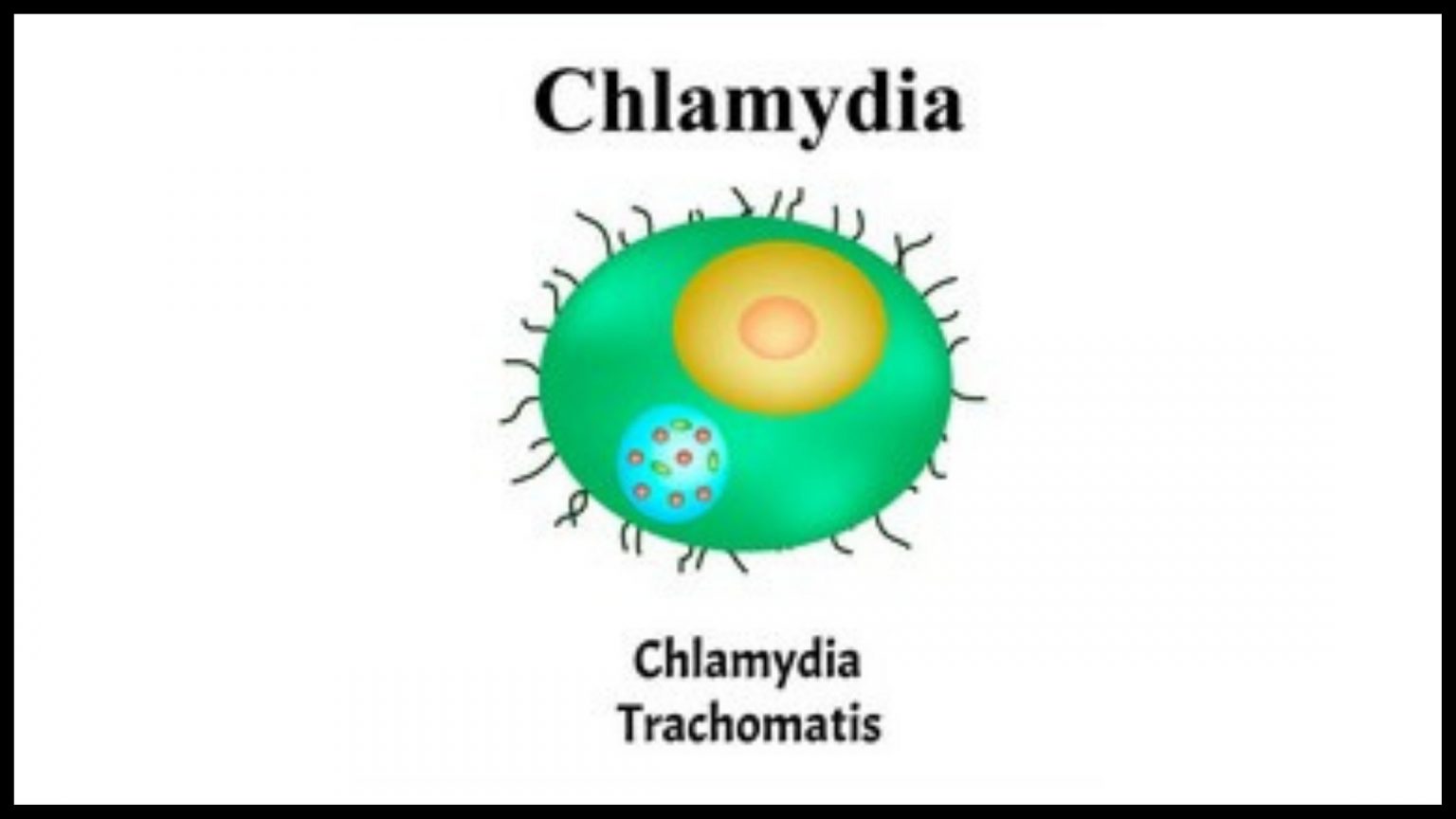 Cottage Cheese Vaginal Discharge Causes Symptoms Treatment   Chlamydia 1536x864 