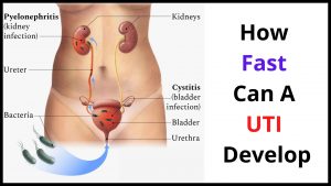 How Fast Can A UTI Develop