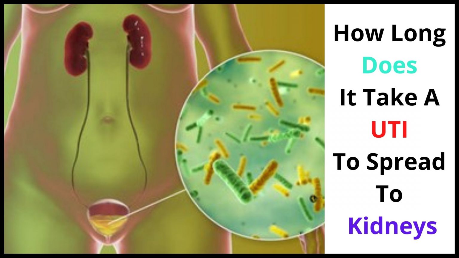 How Fast Can A UTI Develop? What to KNOW & Do!