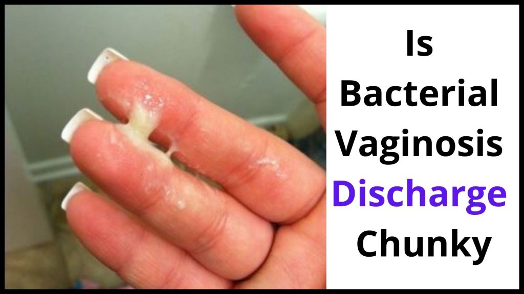 Bacterial Vaginosis Discharge Look Like Here Is It 