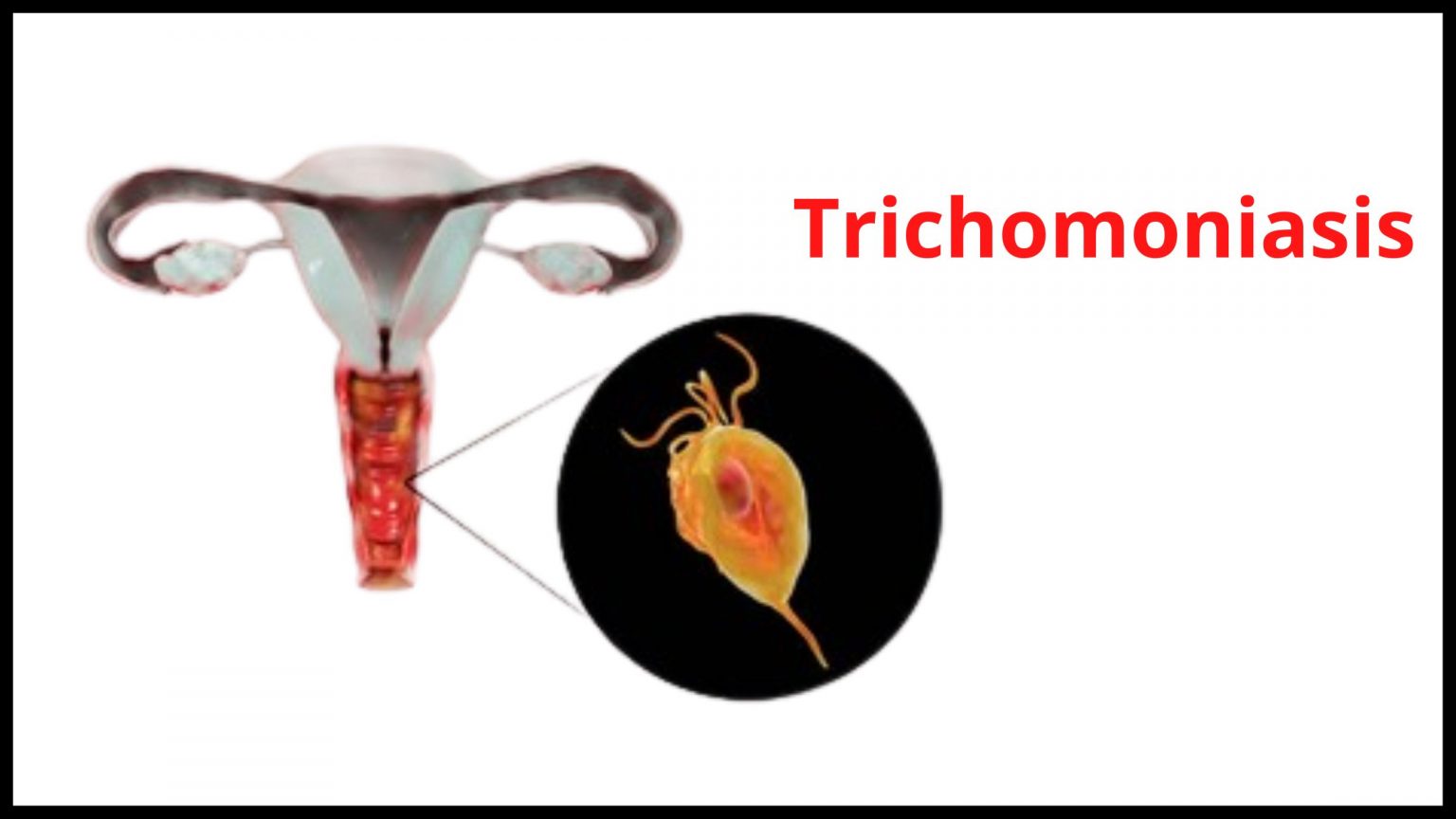 Itchy Swollen Vag After Intercourse Causes & Discharge Treatment