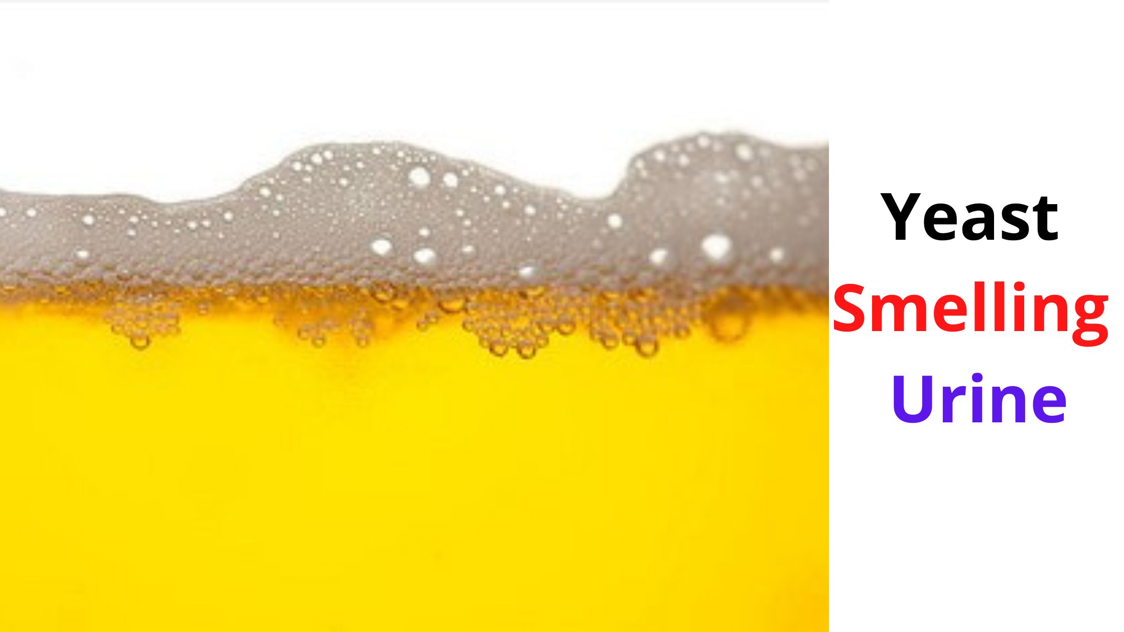 Yeast Smelling Urine: Causes & What Does Yeast Smell Like In Urine?