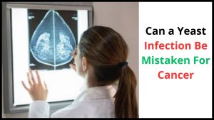 Can a Yeast Infection Be Mistaken For Cancer