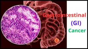 Gastrointestinal (GI) Cancer