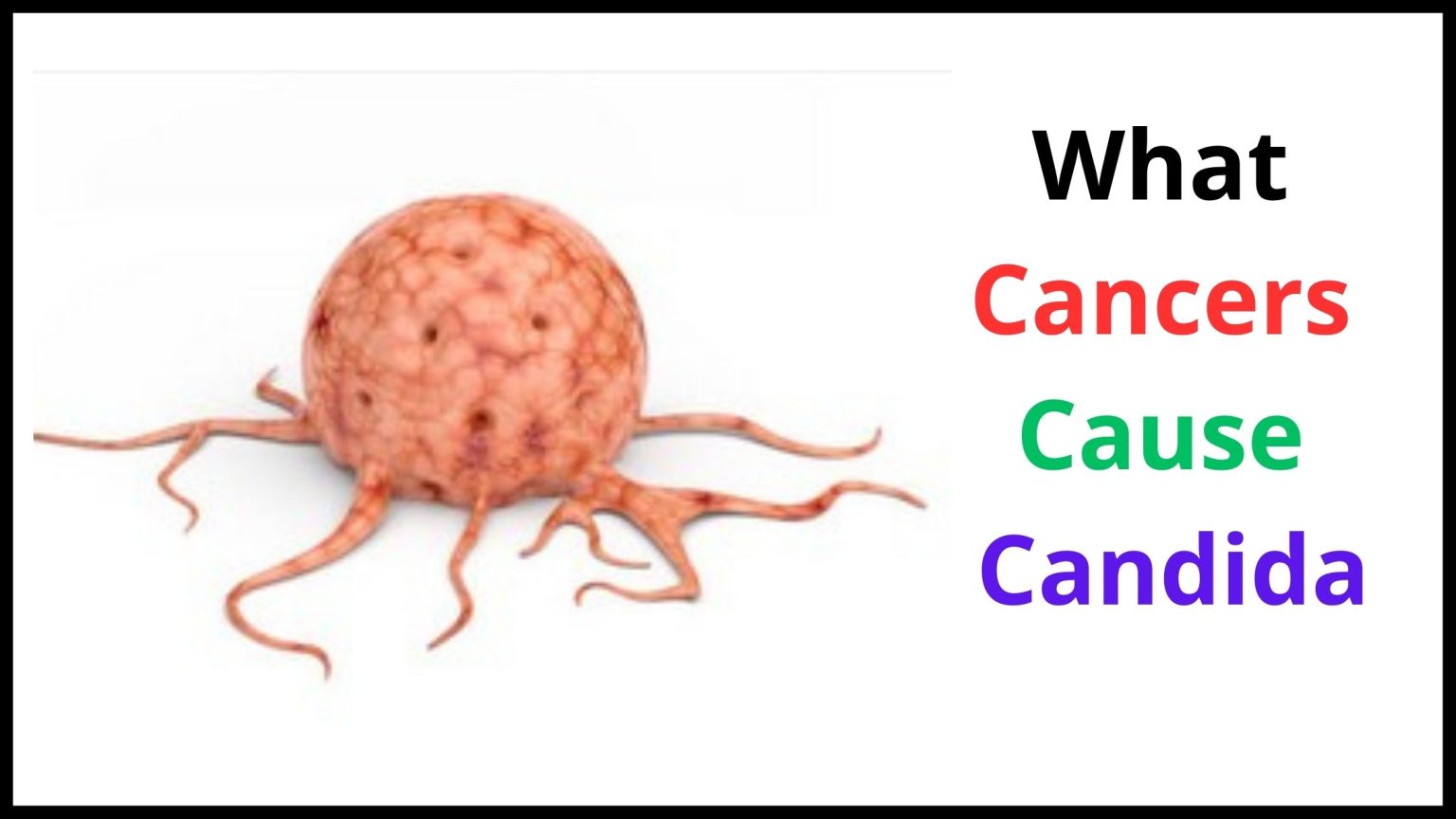 Can Cancer Cause Yeast Infections? The TRUTH!